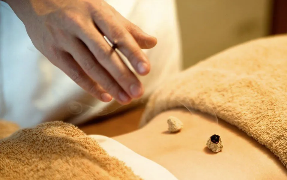 お灸する院長の手