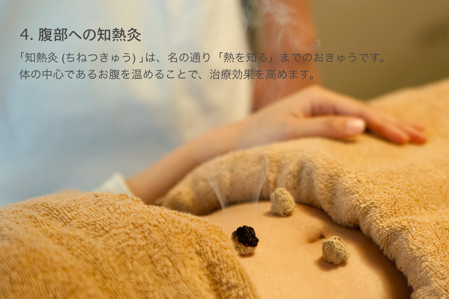治療の流れ-腹部への知熱灸